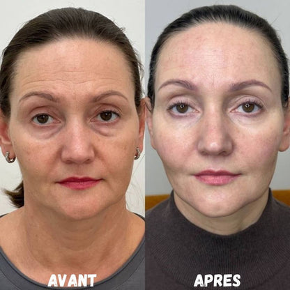 AXIA™ — Le geste simple pour un visage plus net dès le matin
